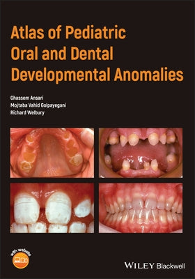 Atlas of Pediatric Oral and Dental Developmental Anomalies by Ansari, Ghassem
