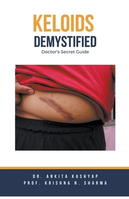 Keloids Demystified: Doctor's Secret Guide by Kashyap, Ankita