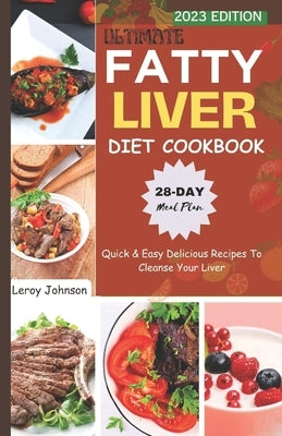 Ultimate Fatty Liver Diet Cookbook: Quick & Easy Delicious Recipes To Cleanse Your Liver by Johnson, Leroy