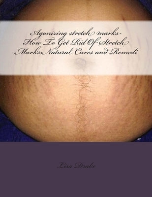 Agonizing stretch marks-How To Get Rid Of Stretch Marks: Natural Cures and Remedi by Drake, Lisa