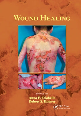 Wound Healing by Falabella, Anna