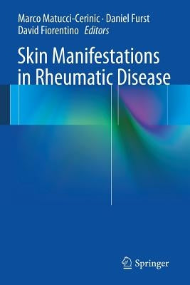 Skin Manifestations in Rheumatic Disease by Matucci-Cerinic, Marco