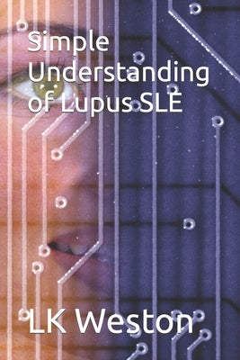 Simple Understanding of Lupus SLE by Weston, Lk