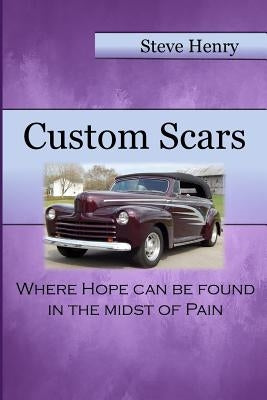 Custom Scars: Where Hope Can Be Found in the Midst of Pain by Williams, April