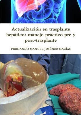 Actualización en trasplante hepático: manejo práctico pre y post-trasplante by Jiménez Macías, Fernando Manuel