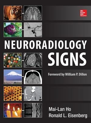 Neuroradiology Signs by Ho, Mai-Lan