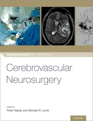 Cerebrovascular Neurosurgery by Nakaji, Peter