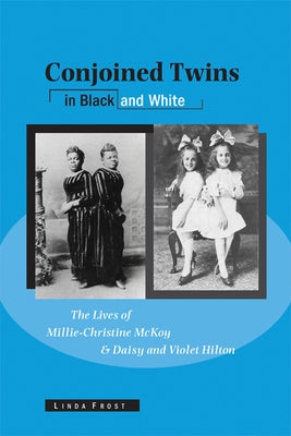 Conjoined Twins in Black and White: The Lives of Millie-Christine McKoy and Daisy and Violet Hilton by Frost, Linda