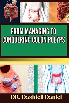 From Managing to Conquering Colon Polyps: Expert Guide To Colon Polyps Causes, Symptoms, Treatment, And Achieving Complete Wellness by Daniel, Dashiell