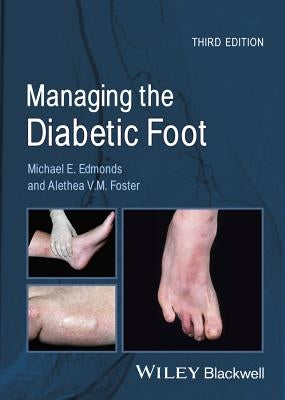 Managing the Diabetic Foot by Edmonds, Michael E.