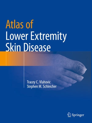 Atlas of Lower Extremity Skin Disease by Vlahovic, Tracey C.