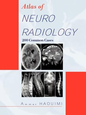 Atlas of Neuroradiology: 200 Common Cases by Haouimi, Ammar