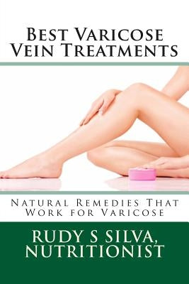 Best Varicose Vein Treatments: Natural Remedies That Work For Varicose by Silva, Rudy Silva