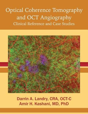 Optical Coherence Tomography and OCT Angiography: Clinical Reference and Case Studies by Landry, Cra Oct-C Darrin a.