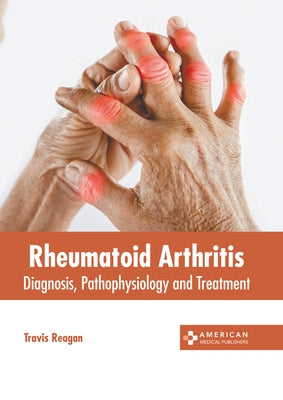 Rheumatoid Arthritis: Diagnosis, Pathophysiology and Treatment by Reagan, Travis
