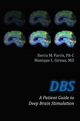 DBS a Patient Guide to Deep Brain Stimulation by Giroux MD, Monique L.