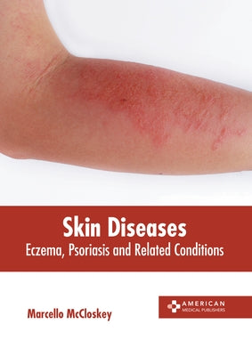 Skin Diseases: Eczema, Psoriasis and Related Conditions by McCloskey, Marcello