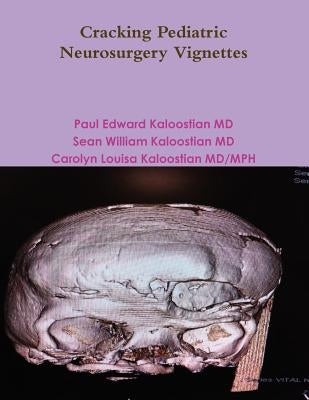 Cracking Pediatric Neurosurgery Vignettes by Kaloostian, Paul Edward