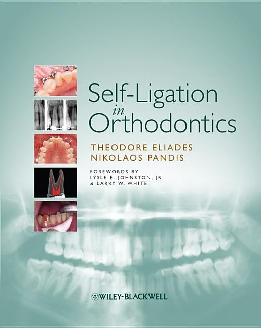 Self-Ligation in Orthodontics: An Evidence-Based Approach to Biomechanics and Treatment by Eliades, Theodore