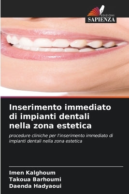 Inserimento immediato di impianti dentali nella zona estetica by Kalghoum, Imen