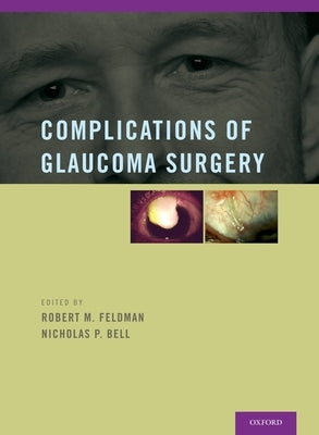 Complications of Glaucoma Surgery by Feldman, Robert M.