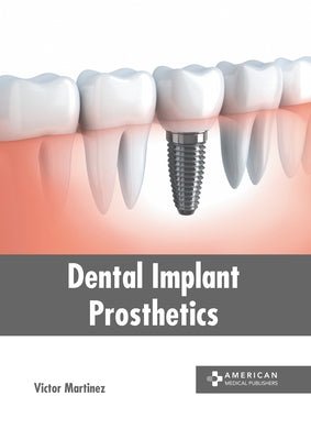 Dental Implant Prosthetics by Martinez, Victor