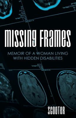 Missing Frames: Memoir of a Woman Living with Hidden Disabilities by Scooter