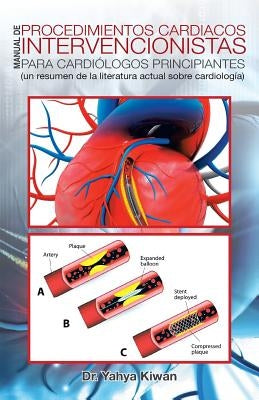 Manual de procedimientos cardiacos intervencionistas para cardiólogos principiantes: (un resumen de la literatura actual sobre cardiología) by Kiwan, Yahya