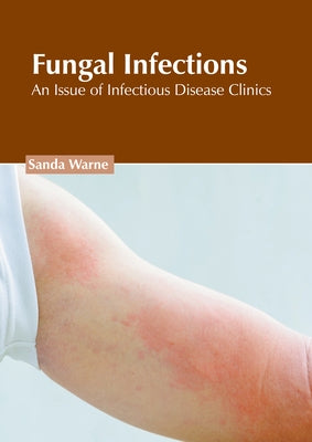 Fungal Infections: An Issue of Infectious Disease Clinics by Warne, Sanda