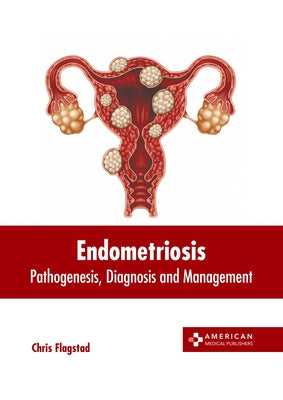Endometriosis: Pathogenesis, Diagnosis and Management by Flagstad, Chris