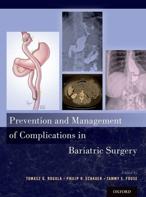 Prevention and Management of Complications in Bariatric Surgery by Rogula, Tomasz G.