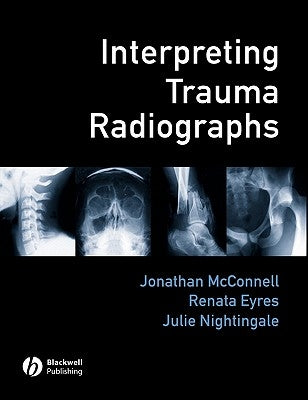 Interpreting Trauma Radiographs by McConnell, Jonathan