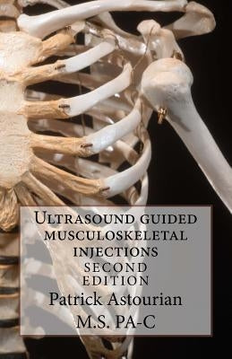 Ultrasound guided musculoskeletal injections by Astourian, Patrick