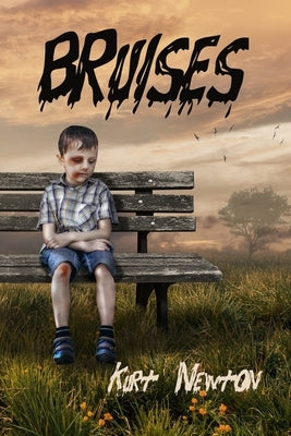 Bruises by Newton, Kurt