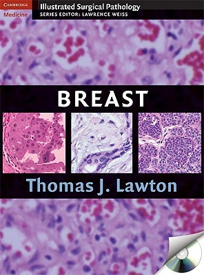 Illustrated Surgical Pathology of the Breast [With CDROM] by Lawton, Thomas