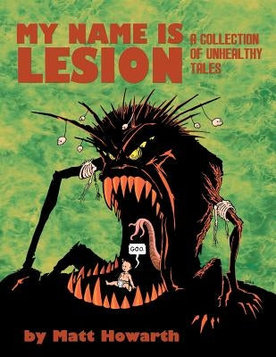 My Name Is Lesion: A Collection of Unhealthy Tales by Howarth, Matt