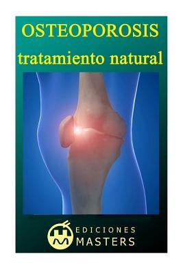 Osteoporosis: Tratamiento natural by Agusti, Adolfo Perez