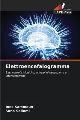 Elettroencefalogramma by Kammoun, Ines