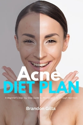 Acne Diet Plan: A Beginner's Step-by-Step Guide to Managing Acne Through Nutrition With Curated Recipes and a Sample Meal Plan by Gilta, Brandon