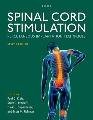Spinal Cord Stimulation: Percutaneous Implantation Techniques by Kreis, Paul G.
