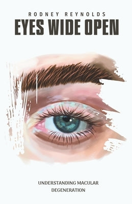 Eyes Wide Open: Understanding Macular Degeneration by Reynolds, Rodney
