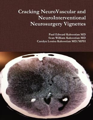 Cracking NeuroVascular and NeuroInterventional Neurosurgery Vignettes by Kaloostian, Paul Edward