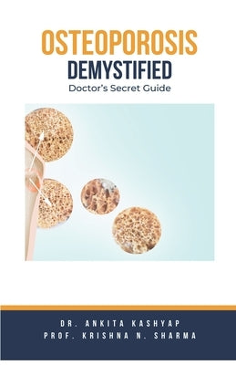 Osteoporosis Demystified: Doctor's Secret Guide by Kashyap, Ankita