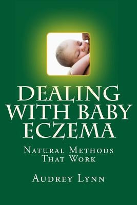 Dealing With Baby Eczema: Natural Methods That Work by Lynn, Audrey
