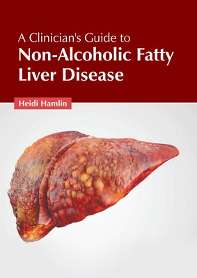 A Clinician's Guide to Non-Alcoholic Fatty Liver Disease by Hamlin, Heidi