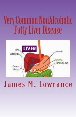 Very Common NonAlcoholic Fatty Liver Disease: How To Know if You Have Hepatic Steatosis by Lowrance, James M.