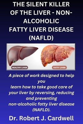 The Silent Killer of the Liver - Non-Alcoholic Fatty Liver Disease: a piece of work designed to help you learn how to take good care of your liver by by Cardwell, Robert J.