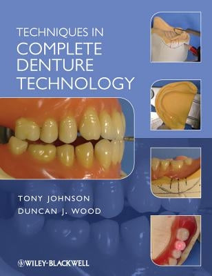 Techniques in Complete Denture by Johnson, Tony
