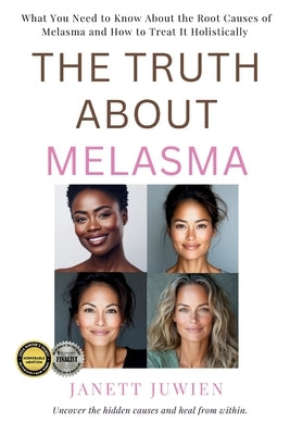 The Truth About Melasma: What You Need to Know About the Root Causes of Melasma and How to Treat It Holistically by Juwien, Janett