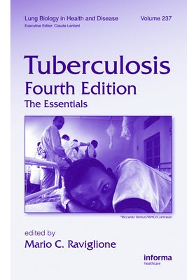 Tuberculosis: The Essentials, Fourth Edition by Raviglione, Mario C.